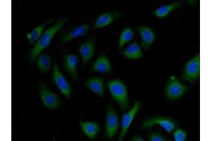 Detection of AKAP11 in Human U2OS Cell using Polyclonal Antibody to A Kinase Anchor Protein 11 (AKAP11)