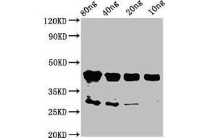 Western Blot Positive WB detected in Recombinant protein All lanes: olig2 antibody at 2 μg/mL Secondary Goat polyclonal to rabbit IgG at 1/50000 dilution Predicted band size: 44 kDa Observed band size: 44 kDa (OLIG2 anticorps  (AA 150-273))