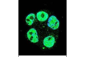 Confocal immunofluorescent analysis of METTL2 Antibody (C-term) (ABIN655892 and ABIN2845293) with ZR-75-1 cell followed by Alexa Fluor 488-conjugated goat anti-rabbit lgG (green).