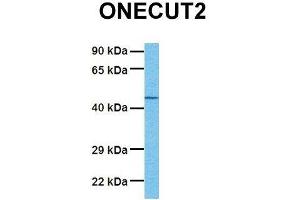 Host:  Rabbit  Target Name:  ONECUT2  Sample Tissue:  Human OVCAR-3  Antibody Dilution:  1. (ONECUT2 anticorps  (Middle Region))
