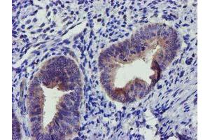 Immunohistochemical staining of paraffin-embedded Human endometrium tissue using anti-SOCS3 mouse monoclonal antibody. (SOCS3 anticorps)