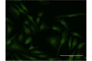 Immunofluorescence of monoclonal antibody to EIF4G2 on HeLa cell. (EIF4G2 anticorps  (AA 811-889))