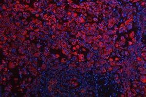 IF analysis of RPS5 using anti-RPS5 antibody (ABIN7599076). (RPS5 anticorps  (AA 1-204))