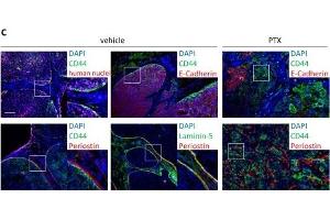 Chemotherapy enriches periostin protein and the mesenchymal cell population in TNBC xenografts.