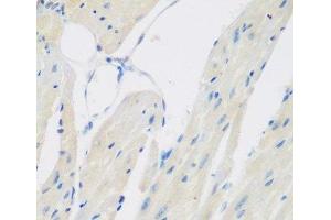 Immunohistochemistry of paraffin-embedded Mouse heart using CCL26 Polyclonal Antibody at dilution of 1:200 (40x lens). (CCL26 anticorps)