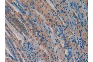 Figure. (CYR61 anticorps  (AA 176-379))