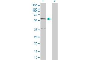 Western Blot analysis of SERPINA10 expression in transfected 293T cell line by SERPINA10 MaxPab polyclonal antibody.