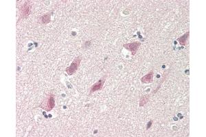 Human Brain, Cortex: Formalin-Fixed, Paraffin-Embedded (FFPE)