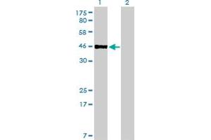 Western Blot analysis of PBX2 expression in transfected 293T cell line by PBX2 monoclonal antibody (M01), clone 2E9. (PBX2 anticorps  (AA 354-430))