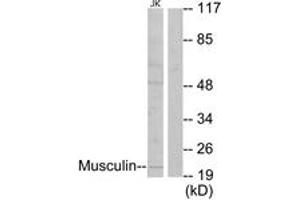 Western blot analysis of extracts from Jurkat cells, using Musculin Antibody. (Musculin anticorps  (AA 131-180))