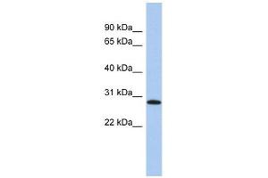 LYSMD1 antibody used at 1 ug/ml to detect target protein. (LYSMD1 anticorps  (N-Term))