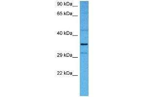 Host:  Rabbit  Target Name:  NFKBIB  Sample Tissue:  Mouse Liver  Antibody Dilution:  1ug/ml
