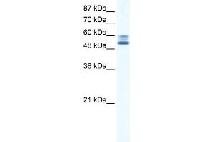 WB Suggested Anti-JMJD2D Antibody Titration:  5. (JMJD2D anticorps  (C-Term))