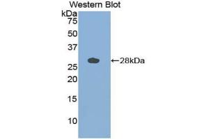 Western blot analysis of the recombinant protein. (Cathepsin S anticorps  (AA 115-331))