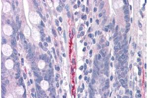 Human Small Intestine, Capillary: Formalin-Fixed, Paraffin-Embedded (FFPE) (FBLN3 anticorps  (C-Term))