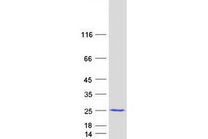 Validation with Western Blot