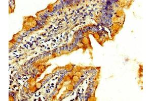 IHC image of ABIN7166997 diluted at 1:300 and staining in paraffin-embedded human small intestine tissue performed on a Leica BondTM system.