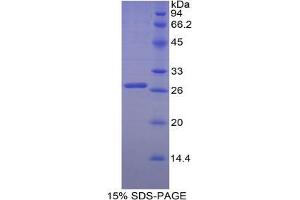 SDS-PAGE analysis of Chicken Transferrin Receptor Protein. (Transferrin Receptor Protéine)