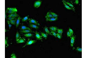 Immunofluorescent analysis of Hela cells using ABIN7149900 at dilution of 1:100 and Alexa Fluor 488-congugated AffiniPure Goat Anti-Rabbit IgG(H+L)