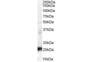 Western Blotting (WB) image for anti-Coiled-Coil Domain Containing 176 (CCDC176) (N-Term) antibody (ABIN2791196) (C14orf45 anticorps  (N-Term))