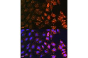 Immunofluorescence analysis of C6 cells using SLC25 antibody (ABIN7270436) at dilution of 1:100.