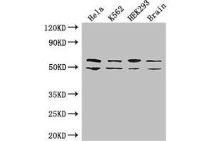 Western Blot Positive WB detected in: Hela whole cell lysate, K562 whole cell lysate, HEK293 whole cell lysate, Mouse brain tissue All lanes: IGF2BP3 antibody at 2 μg/mL Secondary Goat polyclonal to rabbit IgG at 1/50000 dilution Predicted band size: 64, 22 kDa Observed band size: 64, 50 kDa (IGF2BP3 anticorps  (AA 1-100))