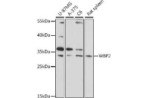 Western blot analysis of extracts of various cell lines, using WBP2 antibody (ABIN7271391) at 1:1000 dilution.