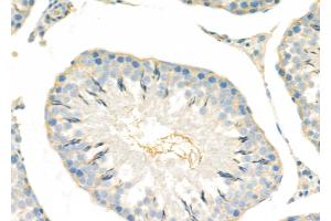 ABIN6265057 and ABIN6279818 at 1/100 staining Rat testis tissue by IHC-P. (SH3GL3 anticorps  (Internal Region))