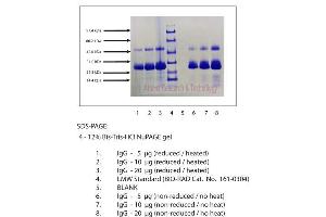 Gel Scan of Immunoglobulin G (IgG), Light Chain, Human Plasma  This information is representative of the product ART prepares, but is not lot specific.