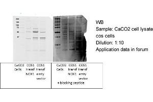 NOX1 antibody - C-terminal region  validated by WB using Epithelial Colorectal Adenocarcinoma CaCO2 at 1:10. (NOX1 anticorps  (C-Term))
