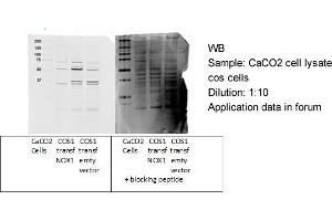 NOX1 antibody - C-terminal region  validated by WB using Epithelial Colorectal Adenocarcinoma CaCO2 at 1:10.