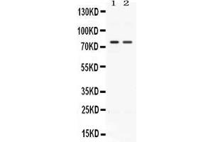 Western blot analysis of ACVR2A expression in rat kidney extract ( Lane 1) and HELA whole cell lysates ( Lane 2). (ACVR2A anticorps  (AA 421-513))