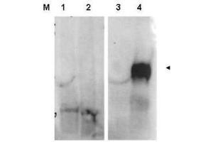 Western blot using  affinity purified anti-FAP antibody shows detection of FAP protein in whole cell lysates from FAP expressing HEK cells (lane 4) but not control HEK cells (lane 3). (FAP anticorps  (Internal Region))