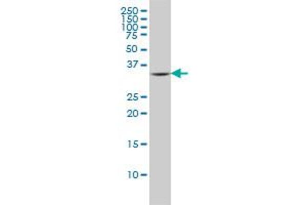 Fc epsilon RI/FCER1A antibody  (AA 1-257)