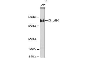 Western blot analysis of extracts of MCF-7 cells, using C11orf30 antibody (ABIN6127846, ABIN6137723, ABIN6137725 and ABIN6221740) at 1:1000 dilution. (EMSY anticorps  (AA 1153-1322))