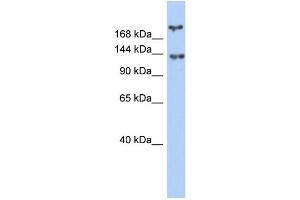 WB Suggested Anti-BRCA1 Antibody Titration: 0. (BRCA1 anticorps  (Middle Region))
