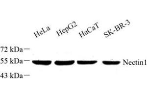 Western blot analysis of Nectin1 (ABIN7074789) at dilution of 1: 500 (Nectin-1 (NECTIN1) anticorps)
