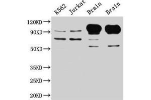 Western Blot Positive WB detected in: K562 whole cell lysate, Jurkat whole cell lysate, Rat brain tissue, Mouse brain tissue All lanes: MAG antibody at 5 μg/mL Secondary Goat polyclonal to rabbit IgG at 1/50000 dilution Predicted band size: 70, 64, 67 kDa Observed band size: 70, 100 kDa (MAG anticorps  (AA 25-516))