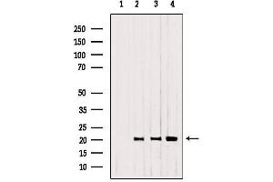 Western blot analysis of extracts from 293，B16F10，Mouse myeloma, using CNPY2,MSAP antibody.