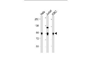 All lanes : Anti-Wee1 Antibody at 1:2000 dilution Lane 1: Hela whole cell lysate Lane 2: Jurkat whole cell lysate Lane 3: K562 whole cell lysate Lysates/proteins at 20 μg per lane. (WEE1 anticorps  (Ser123))