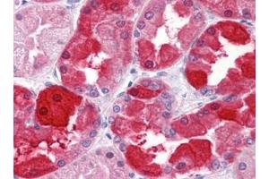 Immunohistochemistry (IHC) image for anti-Crystallin, mu (CRYM) (AA 215-315) antibody (ABIN614593)