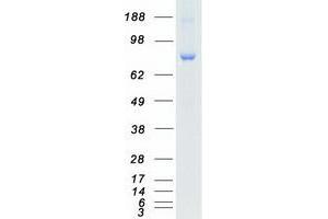 Validation with Western Blot