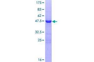 Image no. 1 for RAB25, Member RAS Oncogene Family (RAB25) (AA 1-213) protein (GST tag) (ABIN1317076)