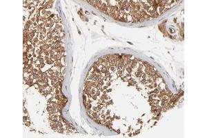 ABIN6266459 at 1/200 staining human testis tissue sections by IHC-P. (FER anticorps  (pTyr402))