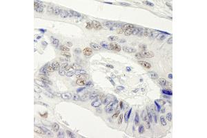 Immunohistochemistry (IHC) image for anti-Symplekin (SYMPK) (AA 1224-1274) antibody (ABIN7448822) (Symplekin anticorps  (AA 1224-1274))