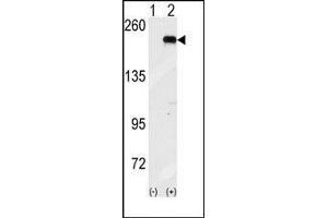 Western blot analysis of GCN2 (arrow) using GCN2 Antibody (GCN2 anticorps  (C-Term))