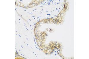 Immunohistochemistry of paraffin-embedded human prostate using KIAA1456 antibody at dilution of 1:200 (40x lens). (KIAA1456 anticorps)