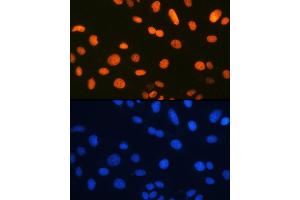 Immunofluorescence analysis of U-2 OS cells using Ku80 Rabbit mAb (ABIN7271406) at dilution of 1:100 (40x lens). (XRCC5 anticorps)