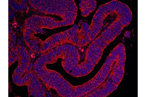 Immunohistochemistry (IHC) image for anti-Filamin B, beta (FLNB) (AA 2552-2602) antibody (ABIN7448565) (FLNB anticorps  (AA 2552-2602))