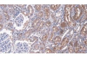 Detection of CD164 in Rat Kidney Tissue using Polyclonal Antibody to Cluster Of Differentiation 164 (CD164)
